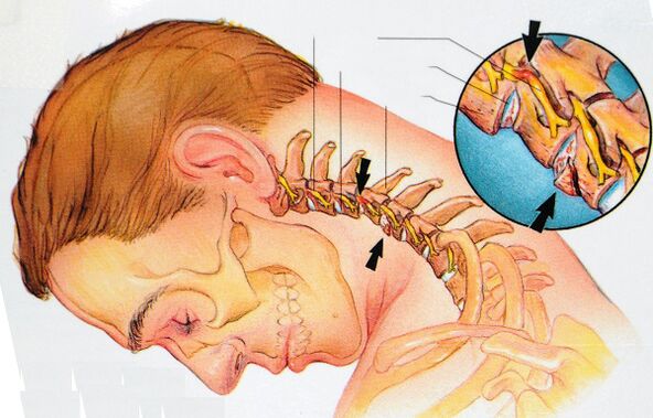 Cấu trúc của đốt sống cổ